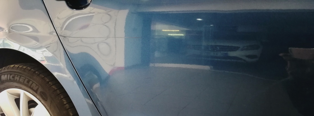 Boyasız Göçük Düzeltme Neden Bu Kadar Önemlidir?